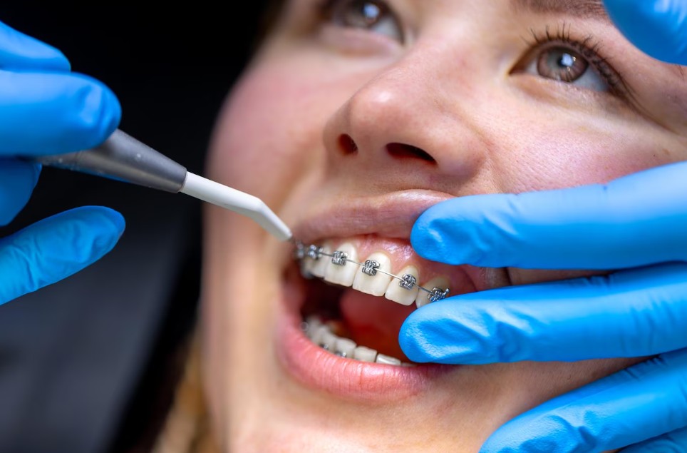 Senior-Orthodontics